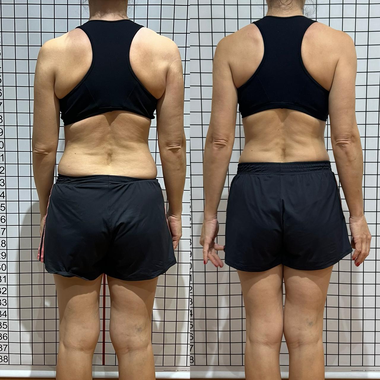 Antes e depois — aluna PROFIT 10