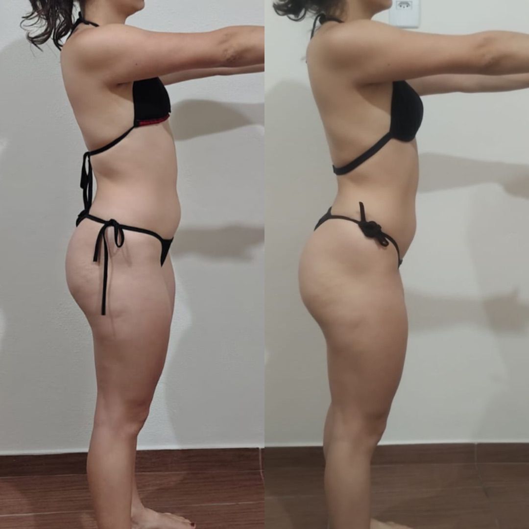 Antes e depois — aluna PROFIT 2