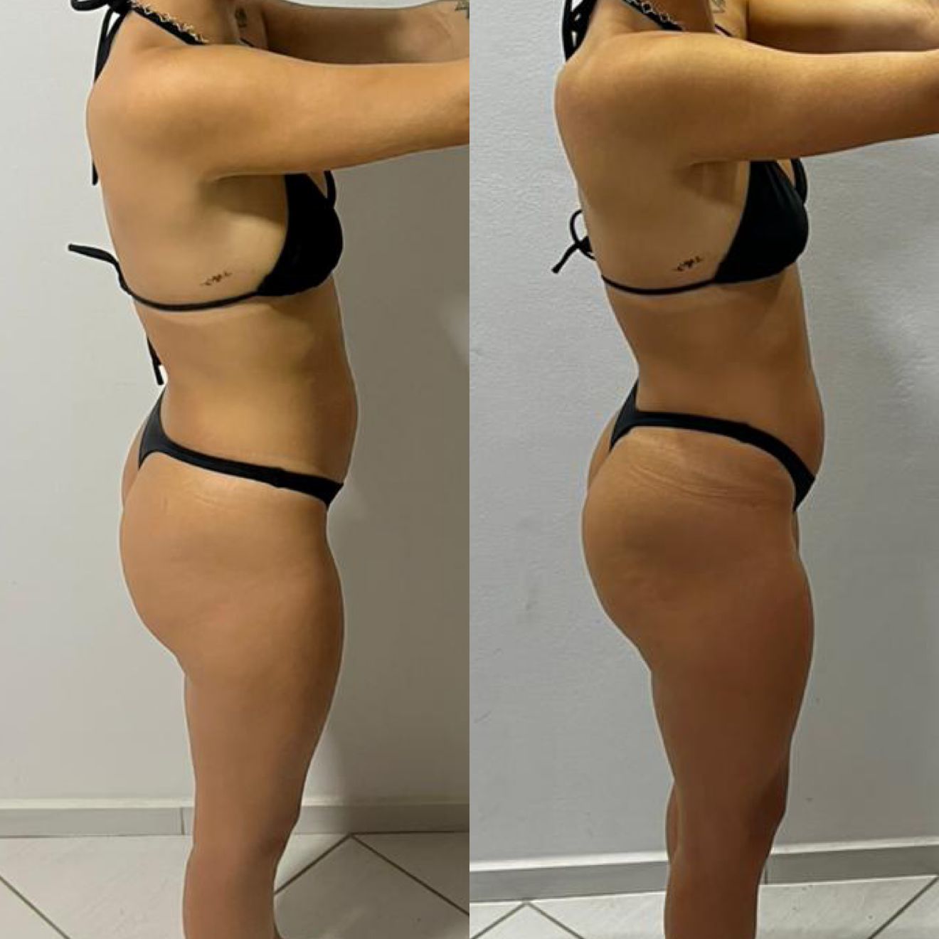 Antes e depois — aluna PROFIT 3