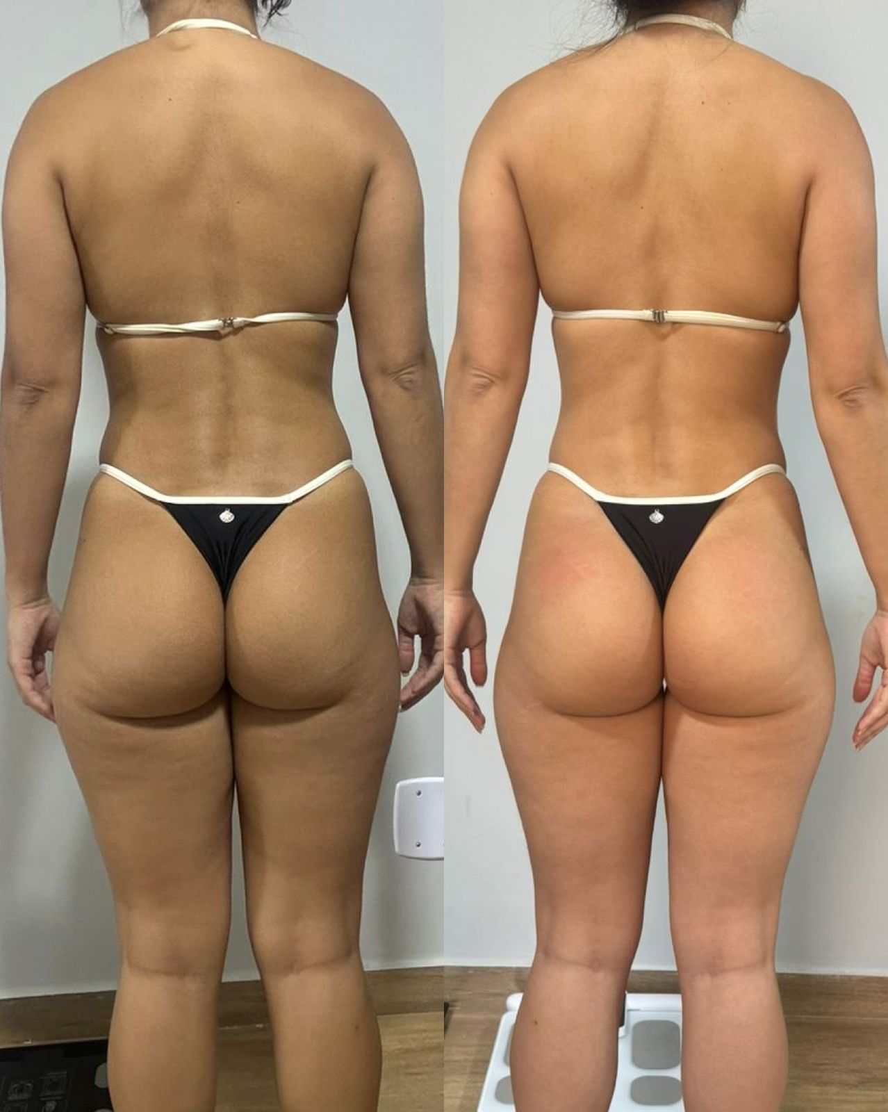 Antes e depois — aluna PROFIT 7